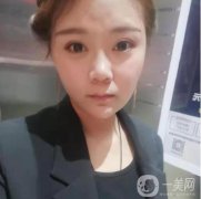 熱瑪吉這個項(xiàng)目，主要是刺激膠原蛋白的再生
