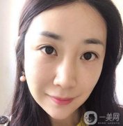 做完熱瑪吉之后，整體的輪廓也是越來越緊致了
