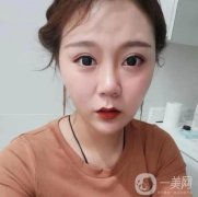 做完熱瑪吉有幾天了，沒有任何不舒服的感覺