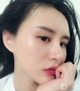 面部填充后，臉摸起來(lái)很軟可以隨意按捏