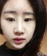 我對(duì)自己的鼻子很清楚，之前一直在微信上和杜達(dá)交流