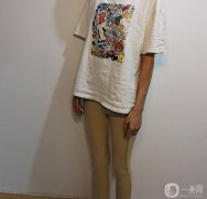 測完我腿脂肪的厚度，做了記錄，然后讓護士帶我下樓體檢