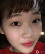 帶著一雙傷心的眼淚，鼻子手術(shù)終于結(jié)束了