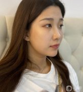 我也想了很久，決定過來做一個(gè)黃金微雕吸脂來解決我的問題