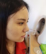 大家好，我終于下定決心做我的鼻子了