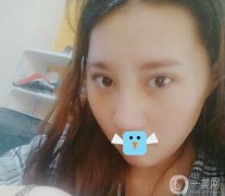 我一直想做鼻子，但是我的鼻子太差了，很難讓它好看