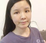 臉部的腫脹正在慢慢減輕，淤青也在消失，越來越正常