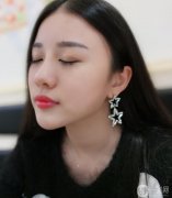 因?yàn)槲业哪槻皇呛芰Ⅲw，醫(yī)生也建議我在打填一個玻尿酸