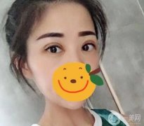 其實(shí)我并沒(méi)有突發(fā)奇想，因?yàn)槲业难劬镞€有大大小小的眼睛