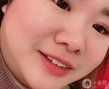 牙齒是人體的重要組成部分，整潔潔白可以提升人的整體體質，讓微笑時更有感