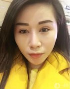 一直想做雙眼皮手術，但還是猶豫不決，因為這雖然是小手術，但畢竟還是在臉