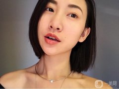 其實(shí)我早就想做埋線了，但是一直在觀望，怕疼，怕遇到不好的醫(yī)生