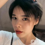 現(xiàn)在可以看到恢復(fù)得相當(dāng)不錯(cuò)，整個(gè)臉真的是越來(lái)越有立體感了