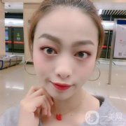 我決定還是去做熱瑪吉了，聽說(shuō)熱瑪吉這個(gè)項(xiàng)目是一個(gè)可以刺激臉部膠原蛋白再