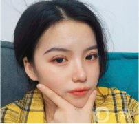 我終于下定決心做雙眼皮了，其實(shí)我想了很久，挑了很多醫(yī)院，看了很多案例，
