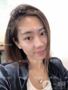 雖然現在做雙眼皮手術不是什么大手術，甚至可以說十有八九做了雙眼皮