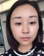 面診時醫(yī)生說面部凹陷相當明顯，尤其是臉頰、太陽穴、額頭