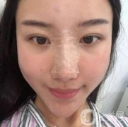 這個丑鼻子降低了我的面值，我想做手術(shù)