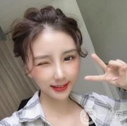 結(jié)合我的面部狀況和鼻子基礎，醫(yī)生為我設計了一系列直鼻類型