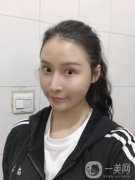 我早就想做面部吸脂了，我去過(guò)很多家，也咨詢過(guò)醫(yī)院