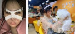 我的鼻子可以說(shuō)是我擔(dān)心的東西