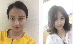 鼻子本身不太好看，一直想做鼻子，但是因?yàn)槭莻€(gè)很糾結(jié)的人，一直糾結(jié)