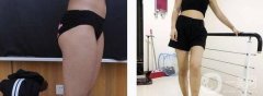 要說惡心的就是數(shù)你的大粗腿，真的不好看