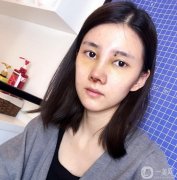 朋友經(jīng)常說我的鼻子，說我的鼻子好像不發(fā)達(dá)