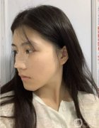 直覺上，如果缺少鼻梁，就要隆鼻