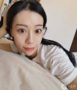 我做線雕的恢復(fù)期很短，別人基本看不到，靜靜的就變美了