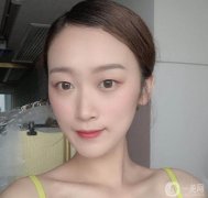 當(dāng)我去打瘦臉針時，醫(yī)生說我的臉實(shí)際上是多肉的，不是因?yàn)橐Ъ?></a>
                            <div   id=