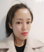 我一直想做雙眼皮手術(shù)，因為眼睛真的很影響我的面值