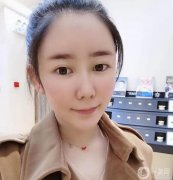 現(xiàn)在臉很自然，填充的部分也很飽滿