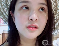一定要特別注意雙眼皮的恢復(fù)期，說怎么剪雙眼皮的睫毛，怎么讓睫毛更長更密