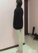 手術(shù)前，我了解了很多醫(yī)院和醫(yī)生的抽脂技術(shù)
