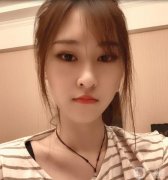 在埋線提升的第15天，到現(xiàn)在為止，感覺效果很好