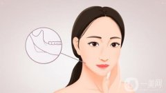 下頜角磨骨手術(shù)需要多少錢？危險(xiǎn)嗎？全新價(jià)格表_注意事項(xiàng)來襲