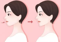 凸嘴焦慮？別再被審美束縛！學(xué)會這些，讓特色變優(yōu)勢