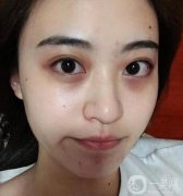 熬夜一時爽，一直熬夜顏值暴跌！拯救你的肌膚，告別“節(jié)后焦慮”