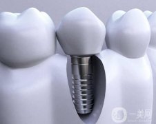 襄陽種牙多少錢一顆啊？種植體品牌+價格介紹，口碑醫(yī)院推薦