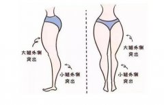 抽脂減肥價格一覽表2024，抽脂減肥安全性一次了解