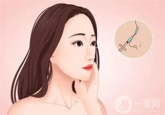 北大深圳醫(yī)院隆鼻案例分享！附崔永言、李天石醫(yī)生專業(yè)擅長(zhǎng)一覽