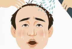 植發(fā)費用大揭秘：這些因素讓你不花冤枉錢！