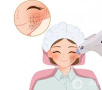 熱瑪吉PK脂肪填充，誰(shuí)更勝一籌？全面解析兩者的優(yōu)劣！
