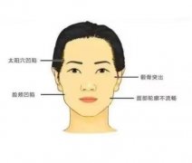 顴骨縮小術(shù)的效果能維持多久？