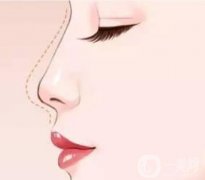 鼻綜合感染的常見癥狀有哪些？