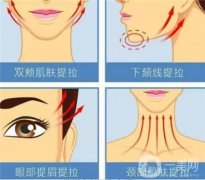 超聲刀手術(shù)可以美白皮膚嗎
