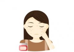 激光祛痘印的原理是什么，有什么注意事項？