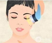 光子嫩膚價(jià)格的影響因素有哪些