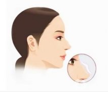 鼻綜合的麻醉安全如何？